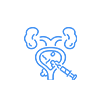 Prostate Surgery