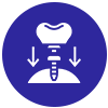 Scaling & Teeth Cleaning