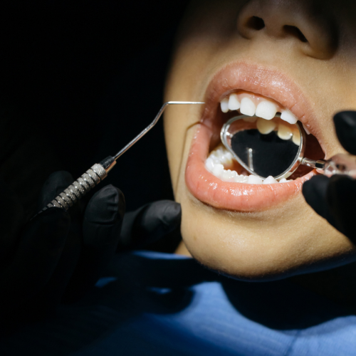 Need a Root Canal Need a Root Canal
